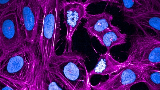 HCA-HCS-Phalloidin512x288px