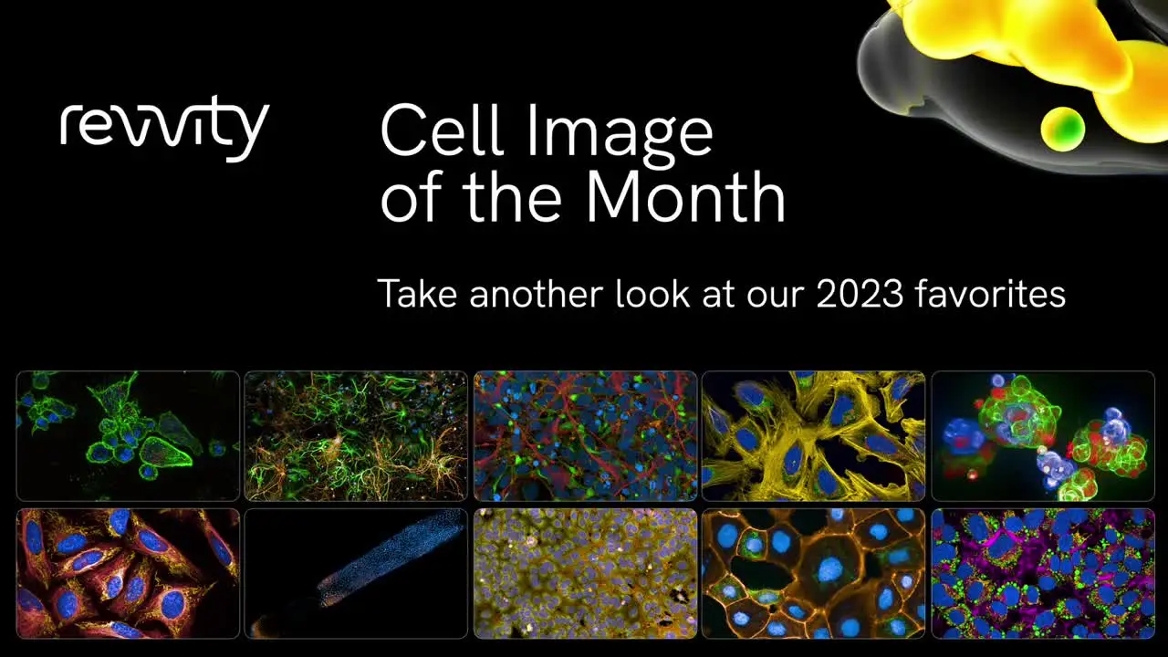 HCS Cell Image of Month