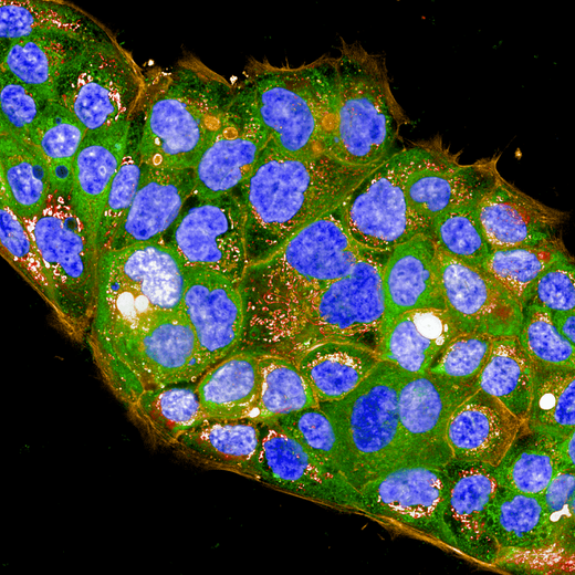 HPAF-II cells stained with PhenoVue cell painting kit, imaged on Operetta CLS high-content analysis system, 63xW, confocal.