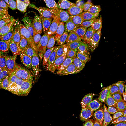 HT-29 cells stained with PhenoVue cell painting kit, imaged on Operetta CLS high-content analysis system, 63xW, confocal.