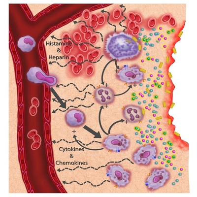 Inflammation Illustration