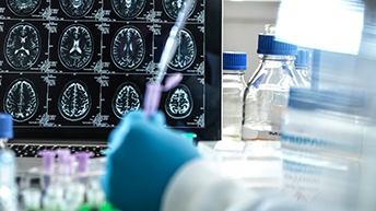 L3Page-7 BACE1_344x194.jpg