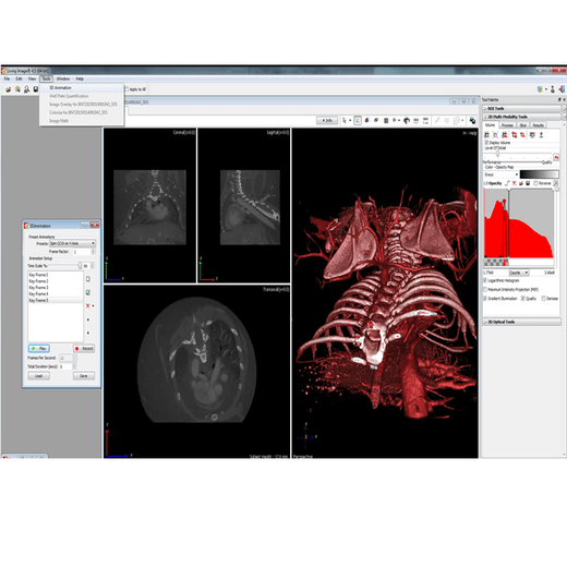 Living Image® analysis software