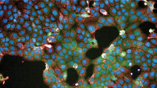 Multi-Parametric_512x288