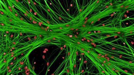 Neuroprotection-Assay-512