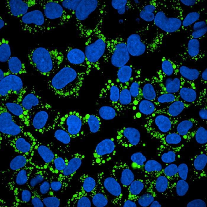 PhenoVue Multi-organelle Staining Kit 1x384 wells | Revvity
