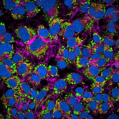HepG2 cells stained with PhenoVue Multi Organelle Staining Kit after oleic acid treatment, imaged on the Opera Phenix Plus HCS system.