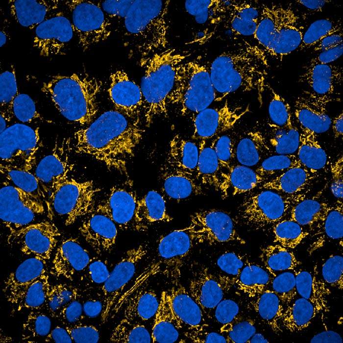 mowl マウルHetrogenityヘトロジェニティマルーンアシッドウォッシュ PhenoVue Multi-organelle Staining Kit 1x384 wells | Revvity