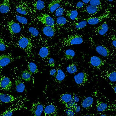 HeLa cells stained with PhenoVue 503 Lysosomal Stain