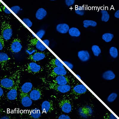 HeLa cells bafilomycin treated stained with PhenoVue 503 Lysosomal Stain