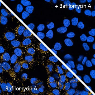 HeLa cells bafilomycin treated stained with PhenoVue 577 Lysosomal Stain