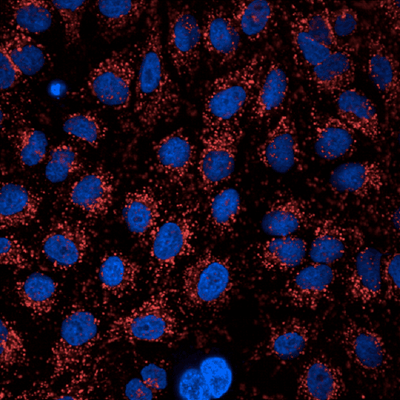 HeLa cells treated with Bafiloycin A, then stained with PhenoVue Hoechst 33342 and PhenoVue 633 lysosomal stain, imaged on Operetta CLS HCA system.