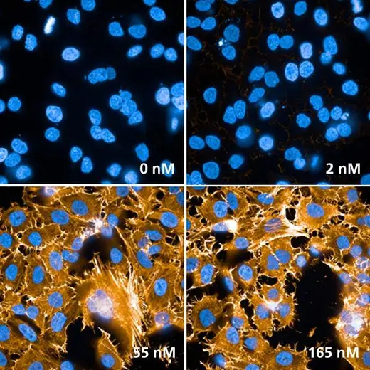 HeLa cells stained with PhenoVue Fluor 555 - Phalloidin