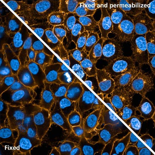 HeLa cells stained with PhenoVue Fluor 555 - WGA