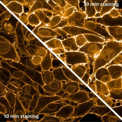 HeLa cells stained with PhenoVue Fluor 555 - WGA