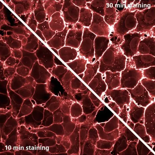 HeLa cells stained with PhenoVue Fluor 647 - WGA