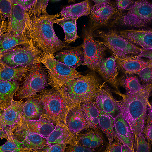 5-plex experiment. HeLa cells stained with five PhenoVue stains (641 mitochondrial stain, Hoechst 33342 nuclear stain, Fluor 400LS - WGA, Fluor 488 - Concanavalin A, and Fluor 568 - Phalloidin). Imaged on Operetta CLS system.