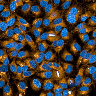 HeLa cells stained with PhenoVue 555 Concanavalin-A