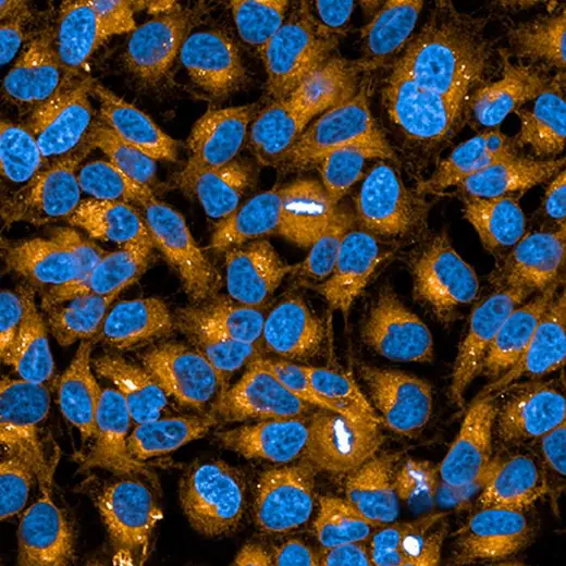 HeLa cells stained with PhenoVue 555 Concanavalin-A