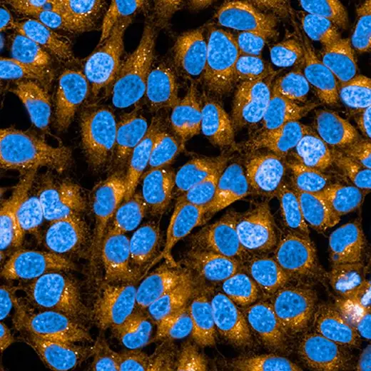 HeLa cells stained with PhenoVue 568 Concanavalin-A