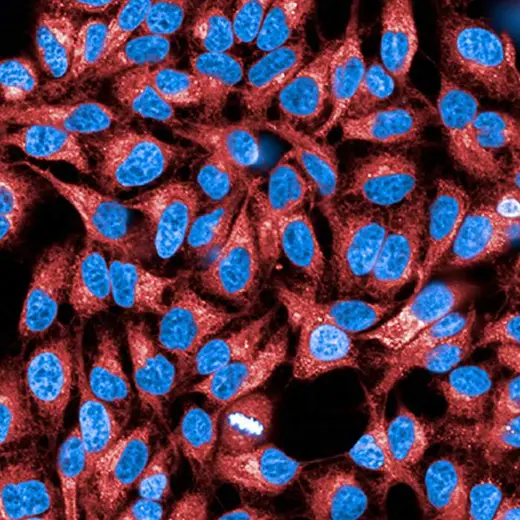 HeLa cells stained with PhenoVue 647 Concanavalin-A