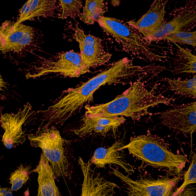 U2OS cells stained with PhenoVue Hoechst 33342 (blue) + PhenoVue Fluor 647 live cell actin stain (red) + PhenoVue Fluor 555 live cell tubulin stain (orange). Cells were then treated with cytochalasin D and imaged on Opera Phenix Plus HCS system.