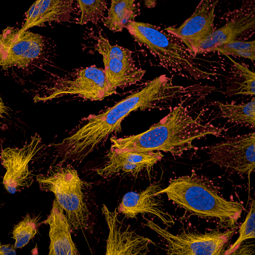 U2OS cells stained with PhenoVue Hoechst 33342 (blue) + PhenoVue Fluor 647 live cell actin stain (red) + PhenoVue Fluor 555 live cell tubulin stain (orange). Cells were then treated with cytochalasin D and imaged on Opera Phenix Plus HCS system.