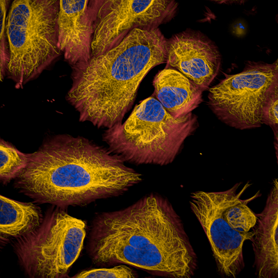 U2OS cells stained with PhenoVue Hoechst 33342 (blue) + PhenoVue Fluor 647 live cell actin stain (red) + PhenoVue Fluor 555 live cell tubulin stain (orange). Imaged on Opera Phenix Plus HCS system.