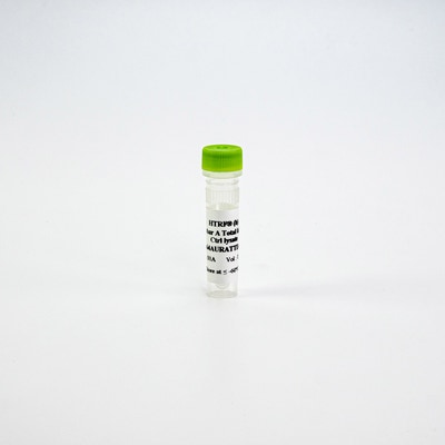 HTRF Human Total Aurora A Detection Kit, Control Lysate