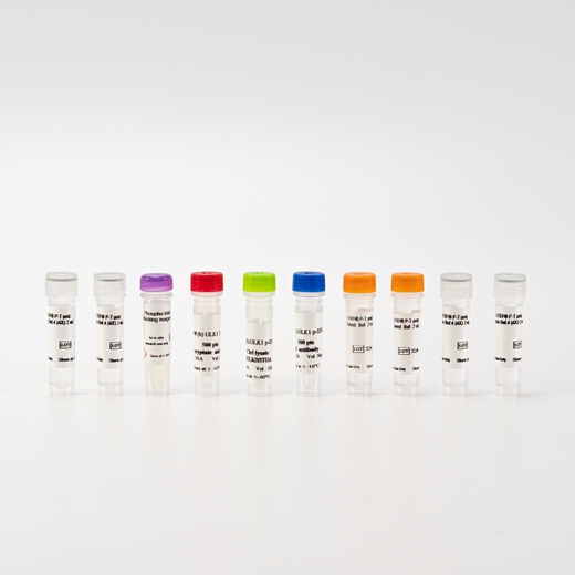 HTRF Human Phospho ULK1 (Ser556) Detection Kit