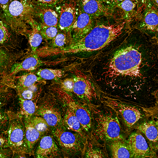 SKOV3 cells stained with PhenoVue cell painting kit, imaged on Operetta CLS high-content analysis system, 63xW, confocal.