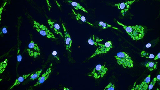Targeting-Leishmaniasis