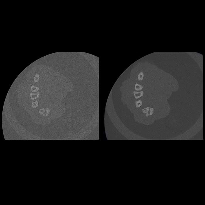 Active ring reduction (ARR) on Quantum GX3 microCT system