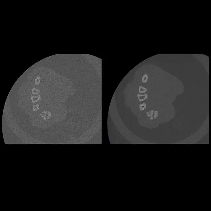 Active ring reduction (ARR) on Quantum GX3 microCT system