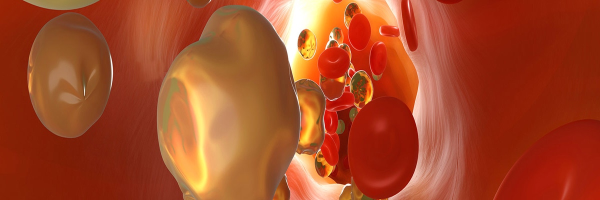 alpha-htrf-atherosclerosis_1920x400