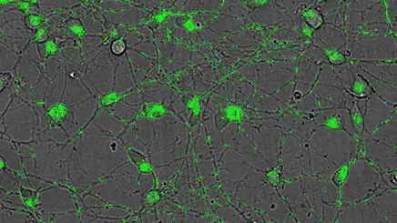analysis-of-mitochondrial-dynamics-in-human-ipsc-derived-neurons-512x288.jpg