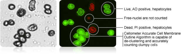 Brightfield Image & AO and PI Counted Overlay