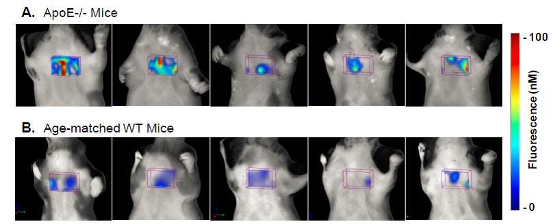 atherosclerosis-fig1