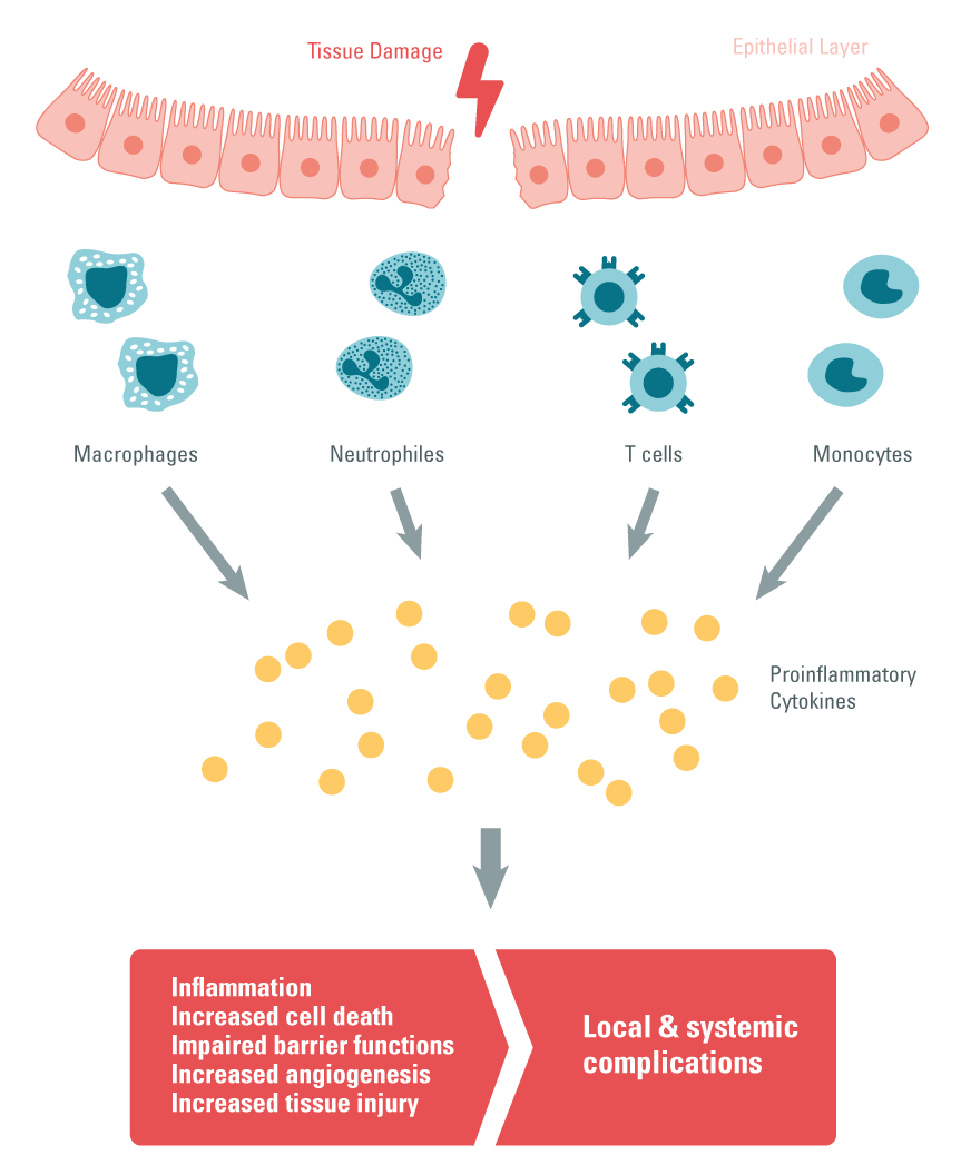 autoimmune-diseases-ibd-inflammatory-pathway