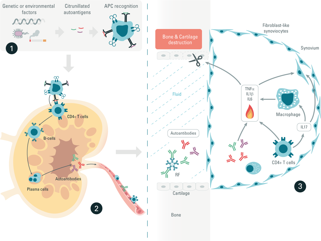 autoimmune-diseases-rheumatoid-arthritis-inflammatory-pathway