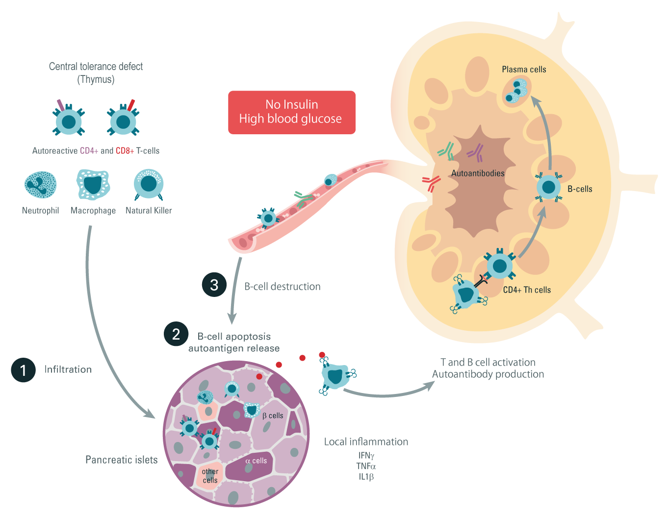 autoimmune-diseases-type-1-diabetes-inflammatory-pathway