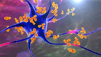 autoimmunity_512x288