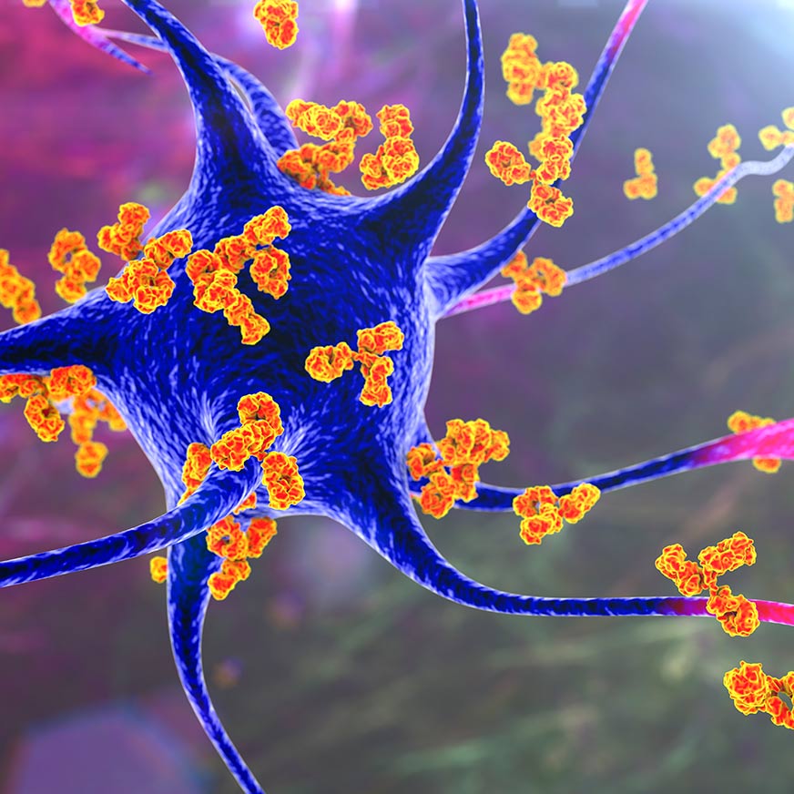 autoimmunity_872x872