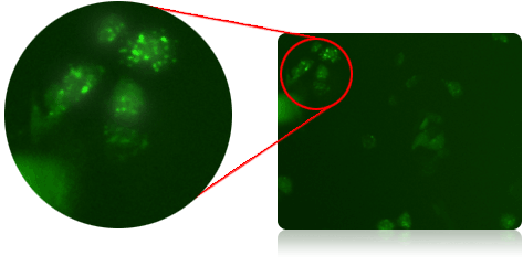 Imaging of GFP-labeled LC3 in PA-TU-8988T cells