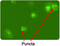 Autophagy puncta