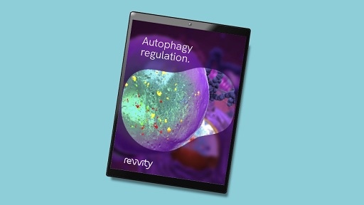 autophagy-regulation-512x288.jpg