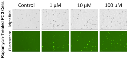 Autophagy trypsinized adherent pc3