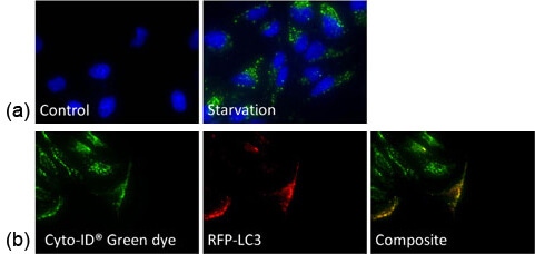 Autophagy validation cyto id 