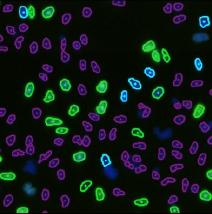 BdrU vs DAPI cell images