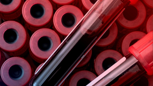 biobank-automation_512x288